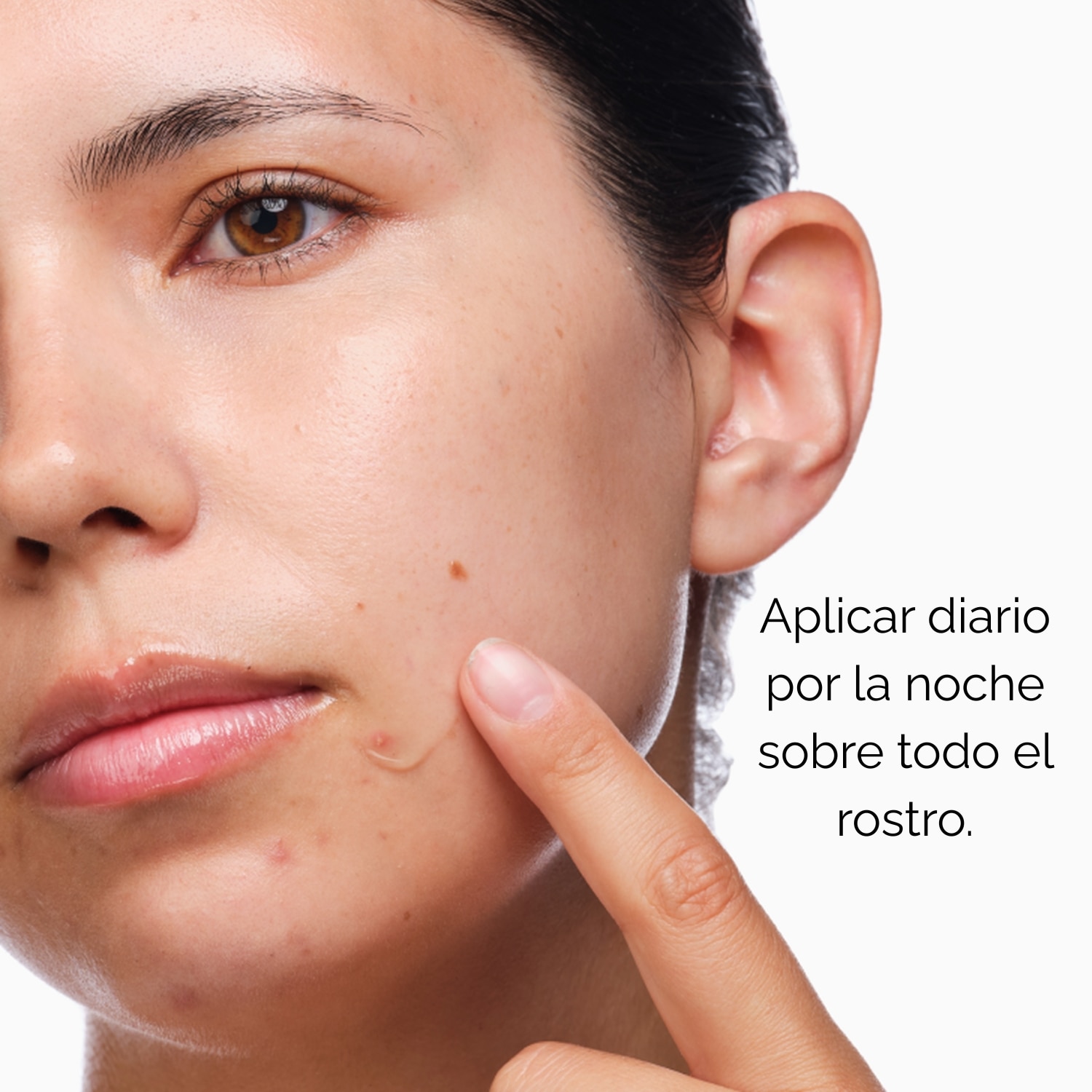 THE CLEAR SET (SET PARA PIELES CON TENDENCIA A ACNÉ)